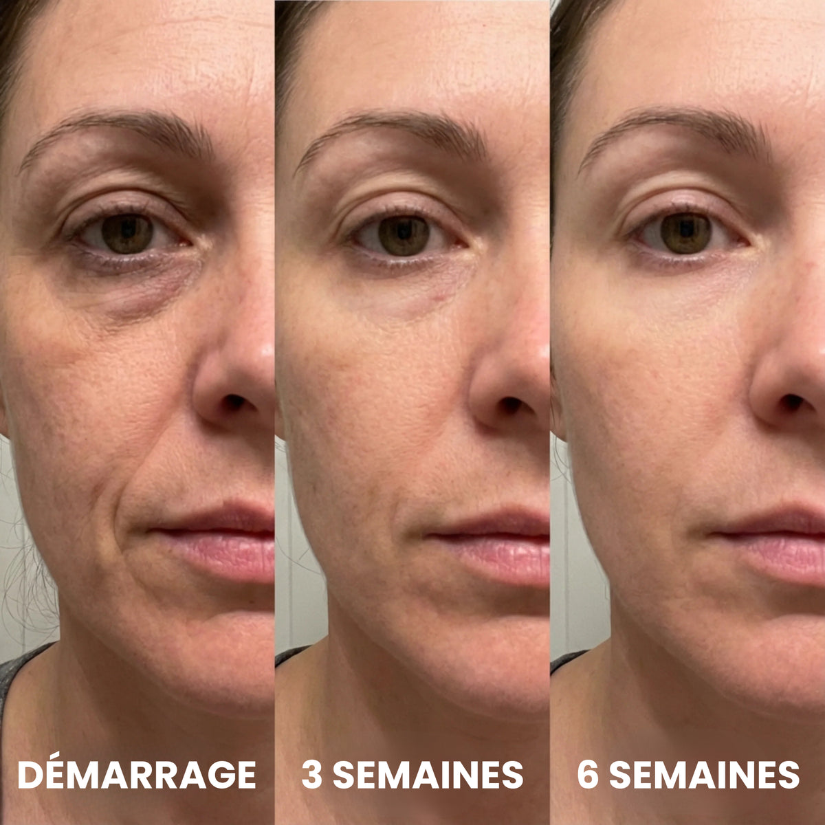 Repulpia – Le Baume Repulpant au Bio-Collagène & PDRN